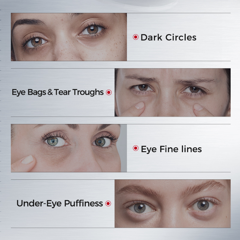 Parches para Ojos para Ojeras  - Sheet Mask Collagen reseña y precio