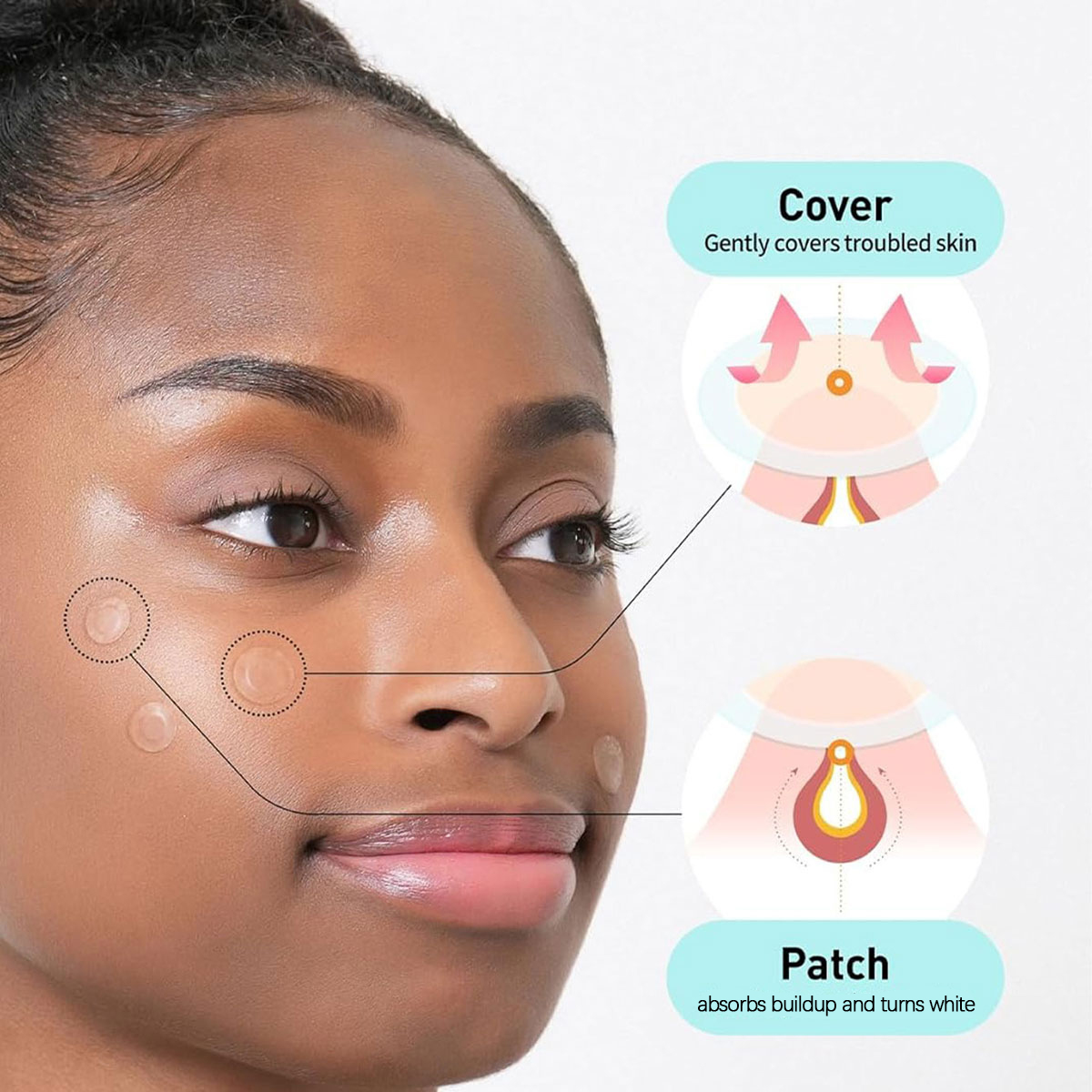 Parches para Cubrir Manchas Ol - Korean Lifestyle reseña y precio